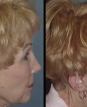 Agata Brys, MD Facial Plastic Surgery image 4