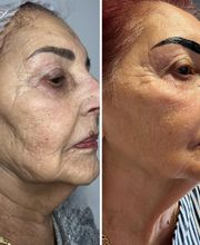 Wrinkle Free WA image 9