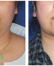 Ethos Plastic Surgery: Ginger Xu, M.D. image 5