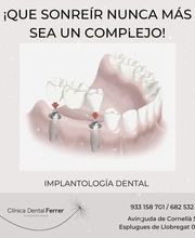 implantologia-dental-esplugues-llobregat.jpg.jpeg