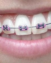 Salaita Orthodontics image 1