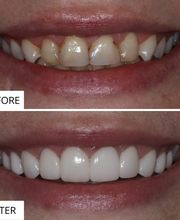 Beaumont Family Dentistry image 15