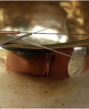 Praxis für TCM und Akupunktur - Martina Hack Bild 2