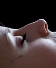 PHÖNIX TCM | Philipp Näf Bild 6