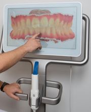 Abdruckfrei und ohne Würgereiz bei Kieferorthopädie Lyss