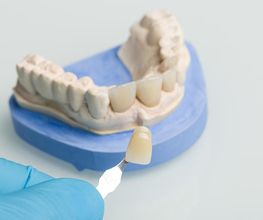 Dentallabor Gunzelmann Bild 2