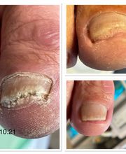 Podologische Praxis Brunsch Bild 9