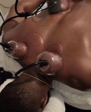 Red Cupping Clinic, LLC image 3