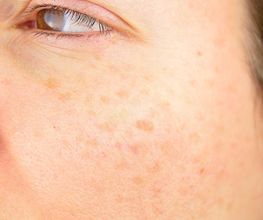 abdermatologia imagen 4