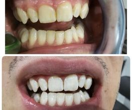 Dentalp SA Bild 2