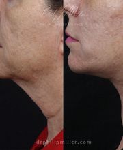 Gotham Plastic Surgery image 20