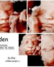 See Baby Ecografía Emocional imagen 16