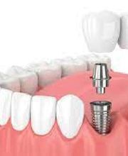 Clínica Dental Vitaldent imagen 7