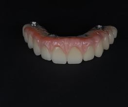 ModeLab Dental Bild 3