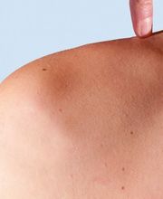 Dynacorium Praktijk voor Huidtherapie
