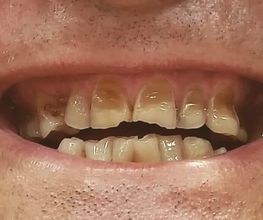 Clínica Dental Quart imagen 14
