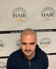 Hair clinic solution spécialiste en micropigmentation du cheveux à Marseille image 12