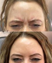 Aesthetics Ink Med Spa image 3