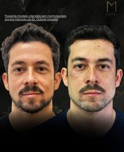 Instituto Marzola | Harmonização Facial imagen 13