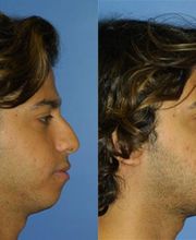 Gotham Plastic Surgery image 16