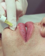 CENTRO ESTÉTICO ESTHER CABALLERO imagen 16