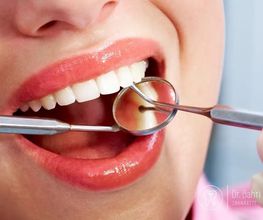 Zahnarzt Zürich Dr. Bahri Adis I Dentalhygiene & Zahnimplantate Zürich I Bleaching Bild 1