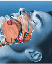Nuumoon® Centre d'Orthodontie et Thérapies Myofonctionnelles Bild 9