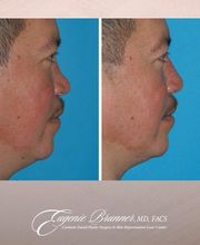 Eugenie Brunner, MD, FACS image 11