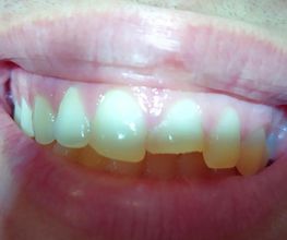 Clínica Dental Quart imagen 7