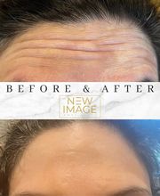 New Image Anti Aging & Weight Loss Center image 7