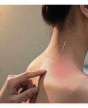 AcuraPoint - Médecine traditionnelle chinoise Bild 6