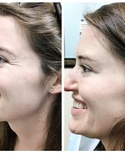 dermani MEDSPA Roswell image 7
