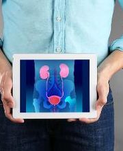 UROX imagen 2