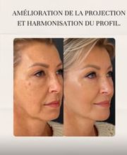 ALPINE SKIN CLINIC / Dr ZD CLINIC Bild 10