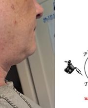 Paticillo Tattoo Bild 6