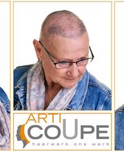 Alopecia Totalis
