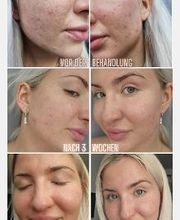 Kosmetikstudio ÄsthetikFee Bild 7