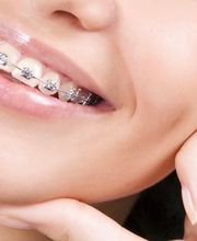 Cabinet d'Orthodontie Dr Monica Lordelo Bild 1