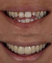 Northeast Lincoln Family Dentistry image 9