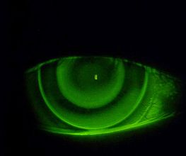 Fleury Opticiens SA Bild 8