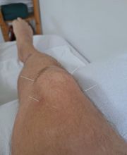 Akupunktur, traditionelle chinesische Medizin und Naturheilverfahren - TCM Praxis Dr. Miersch Bild 7