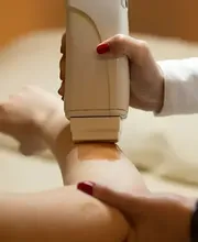 Das Bild zeigt eine Kosmetikerin, die einen Epilierer verwendet, um feine Haare auf dem Unterarm einer Kundin zu entfernen. Der Arm liegt stabil, während das Gerät präzise über die Haut geführt wird. Die Szene wirkt professionell, hygienisch und zeigt eine gängige Methode der Haarentfernung im kosmetischen Bereich. Der Fokus liegt auf dem Epiliergerät und der sorgfältigen Anwendung durch die Fachkraft.