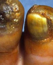 Consulta Barreiro-Vascular (Drs. A. Barreiro Mouro y J. Barreiro Veiguela) imagen 7