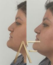 Dr Alexis Fernandez | Medicina Estetica imagen 4