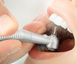 MI ESPACIO DENTAL imagen 3