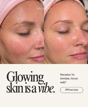 WildState Lawton image 7