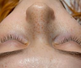 Fake Freckles - Skink Studio - Studio für Permanent Make-up in Köln