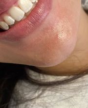 My Smile and More Schönheitsyentrum Köln Neumarkt