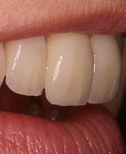 SE Dentaltechnik GmbH Bild 1