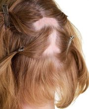 Articoupe afbeelding 12